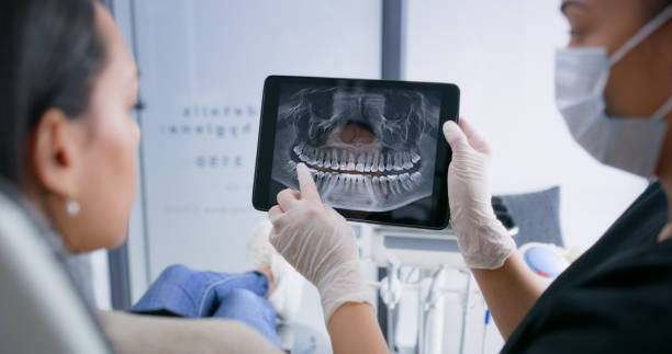 Licensed Teeth Whitening service in Westwood Lakes, FL - Smile Center Dentistry